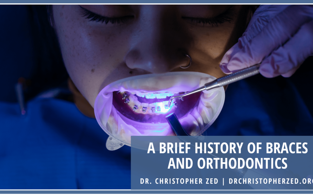 A Brief History Of Braces And Orthodontics Min
