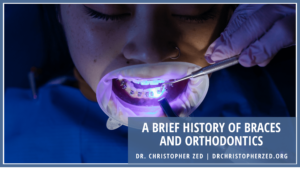 A Brief History Of Braces And Orthodontics Min