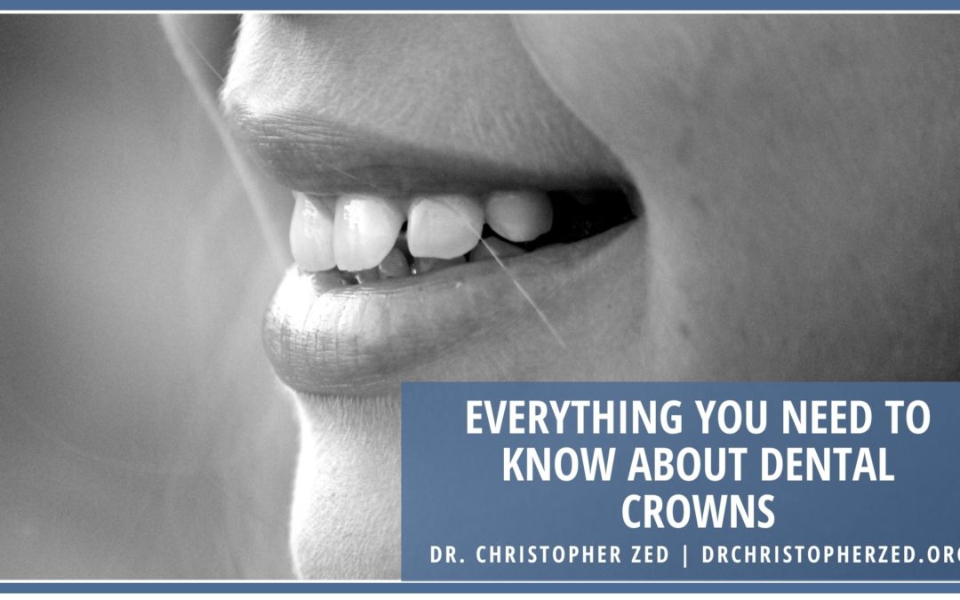 Everything You Need to Know About Dental Crowns
