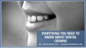 Everything You Need To Know About Dental Crowns